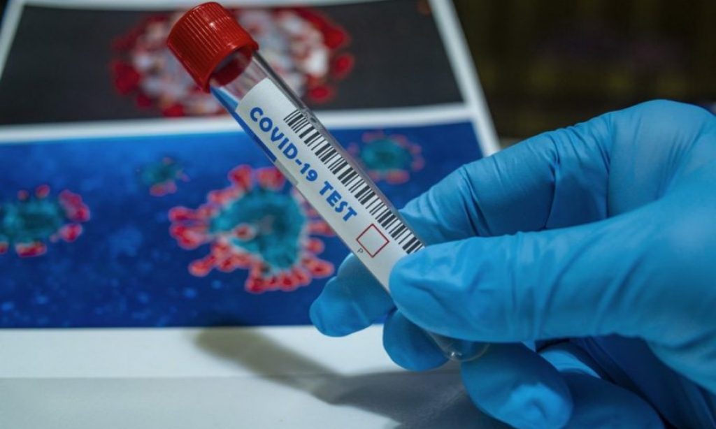 KORONAVIRUS: Jučer niti jedan pozitivan test